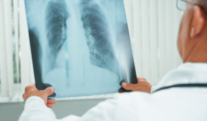 lekarz ogląda zdjęcie płuc